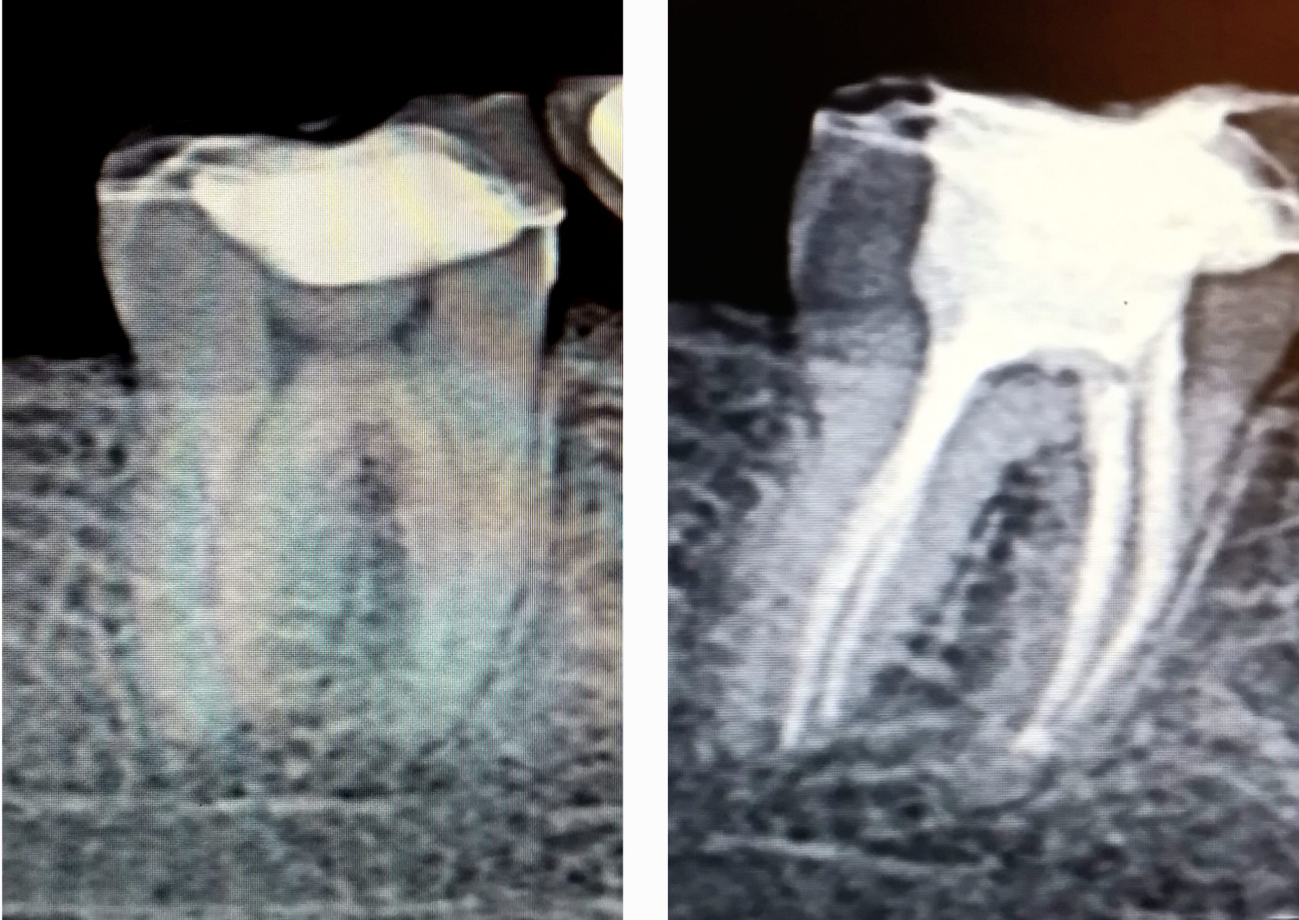 Surgery & Endodontics